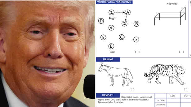 'Not a test of IQ': Doctor who designed cognitive test addresses Trump's boasts