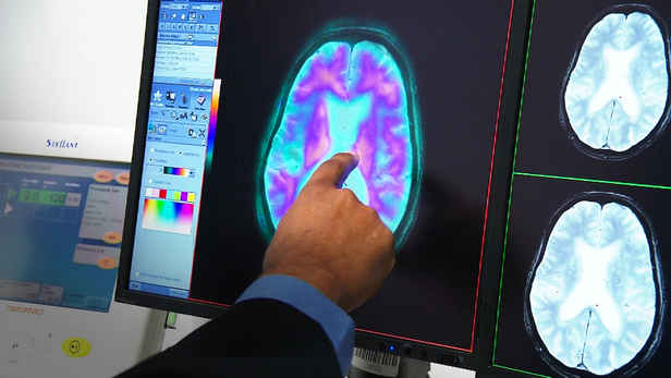 Almost half a million Aussies are living with the nation's biggest killer